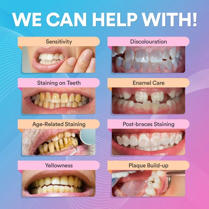 Gentle PAP+ Teeth Whitening Kit - Powerful Whitening, Zero Sensitivity thumbnail 3