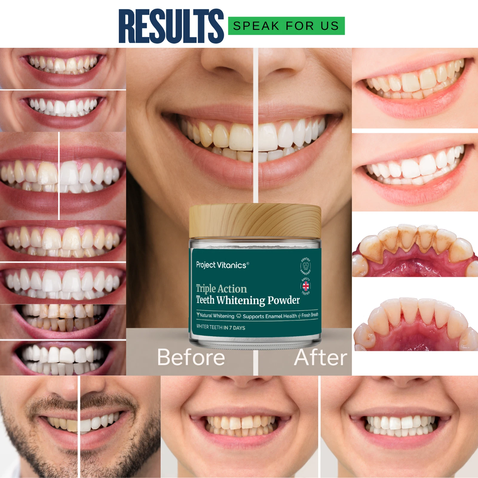 Teeth Whitening Powder - Tooth Whitening Powder - Natural - Sensitivity Free thumbnail 16