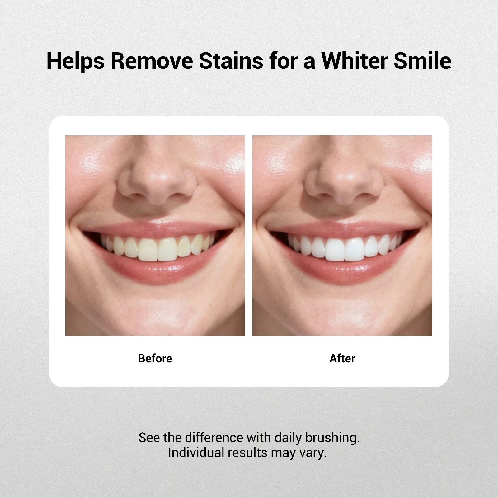 MSDRWIKEY 7-Pro Toothpaste with 7 Probiotics Powerful Whitening thumbnail 5