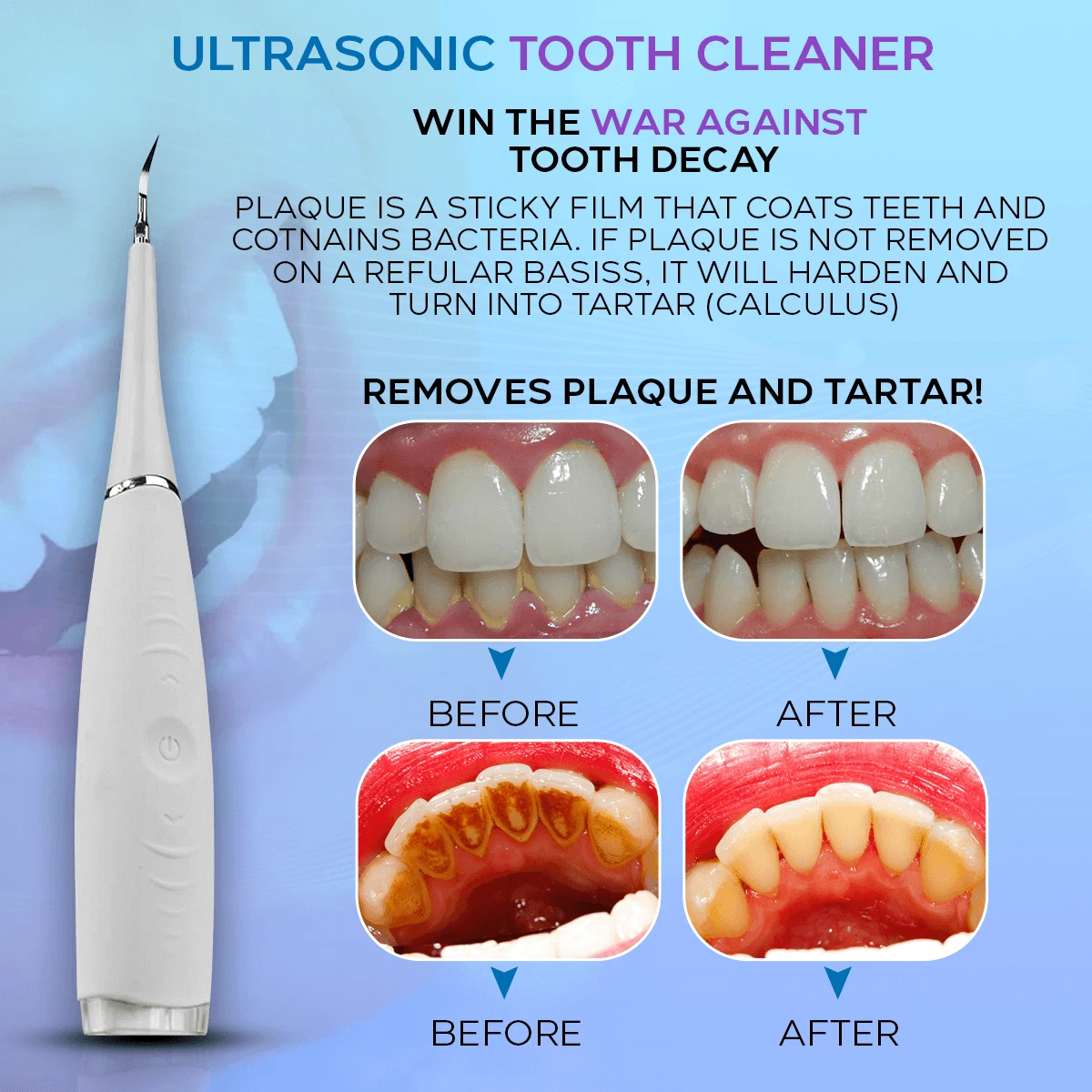 Electric Plaque Remover for Teeth with 5 Modes Dental Sonic Tartar Tooth Cleaner thumbnail 5