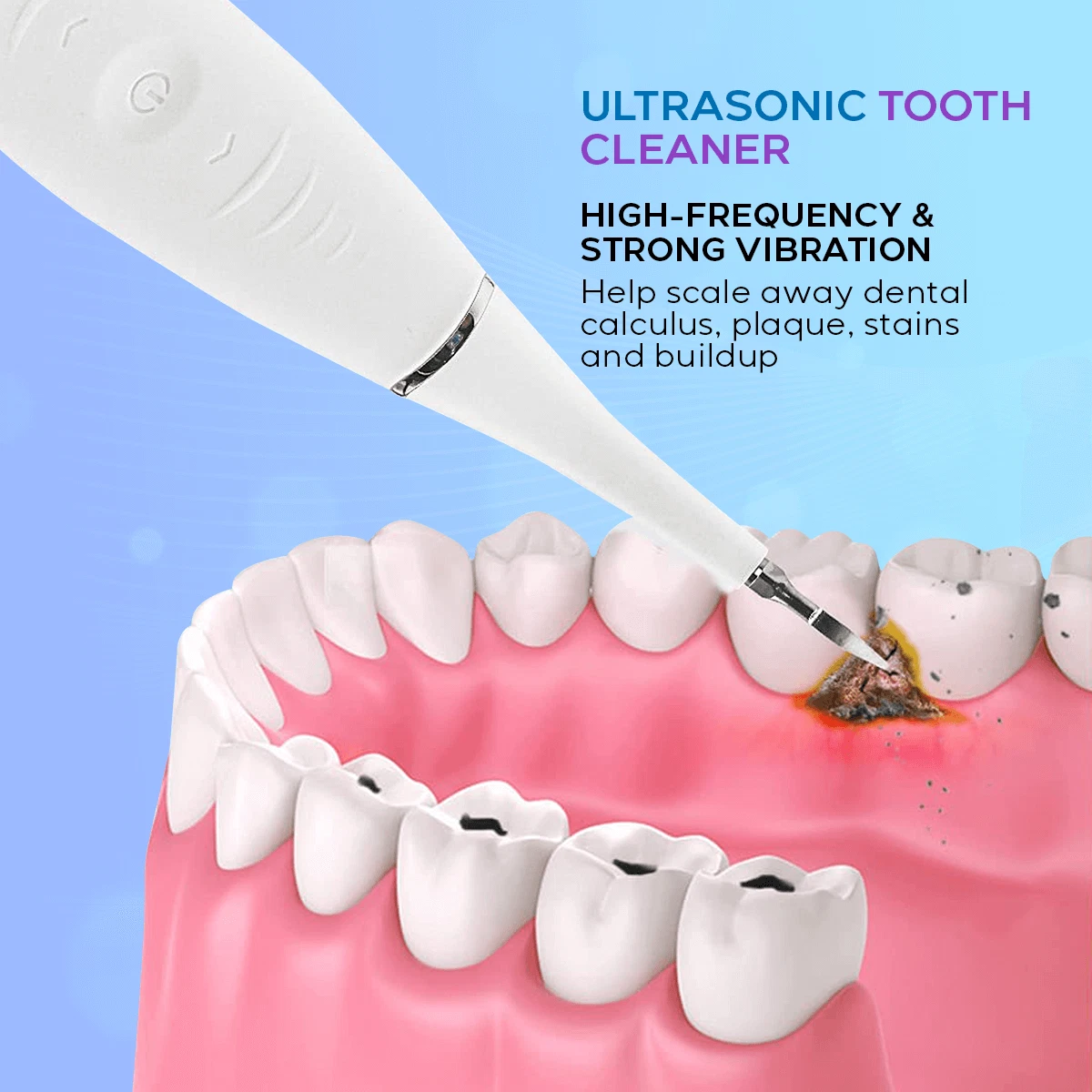 Electric Plaque Remover for Teeth with 5 Modes Dental Sonic Tartar Tooth Cleaner thumbnail 6